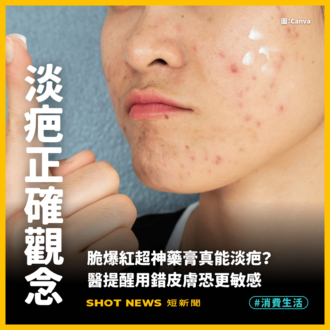 爆紅痘疤神藥?醫:用錯恐引發肌膚敏感